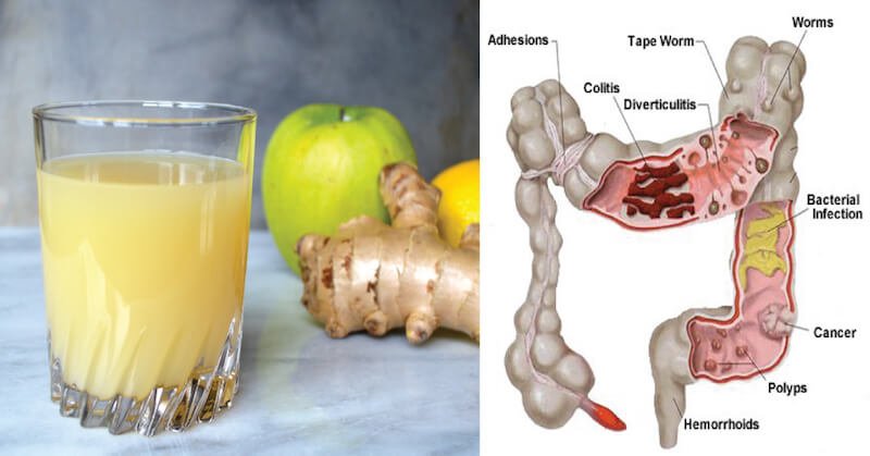 Release Pounds of Toxins From Your Body with this 3-Ingredient Apple Ginger Lemon Colon Cleanse Juice