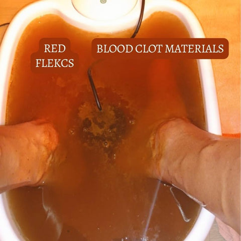 【Official Brand】Ionic Foot Spa - At-home detox and cleanse!