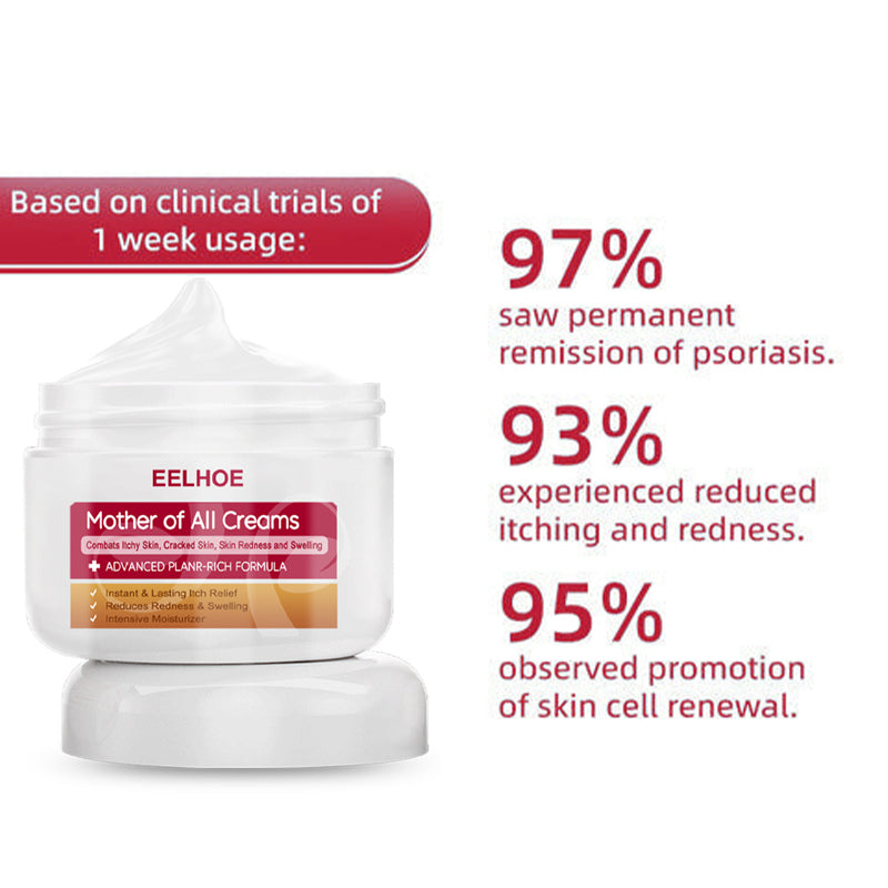 EELHOE™ Multi- Symptom Psoriasis Treatment Cream