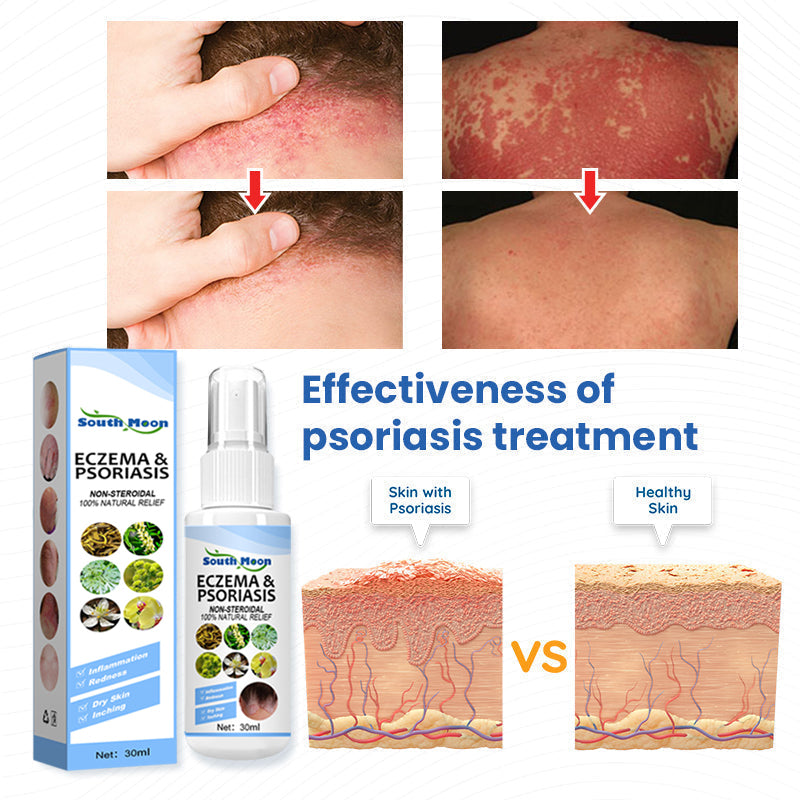 MEELLOP ™ Herbal Psoriasis Relief Spray