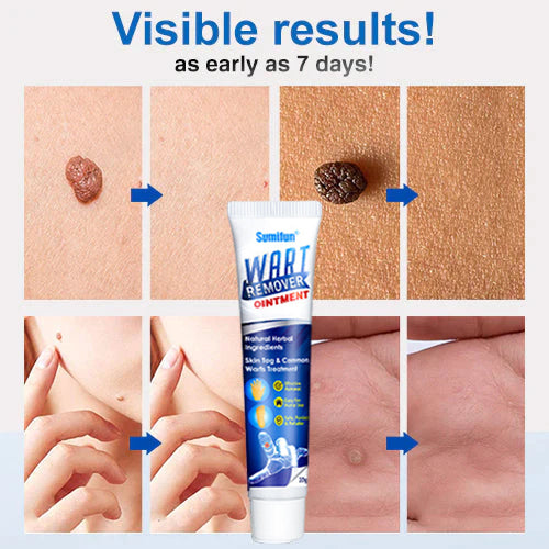 Sumifun ™ Wart Removal Salva