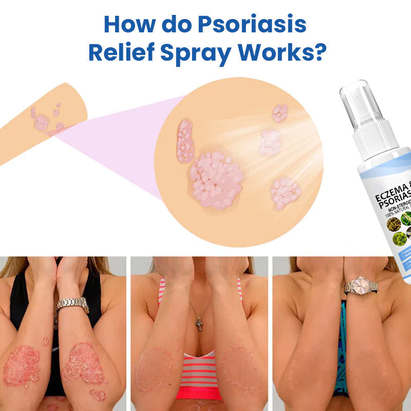 MEELLOP ™ Herbal Psoriase Relief Spray