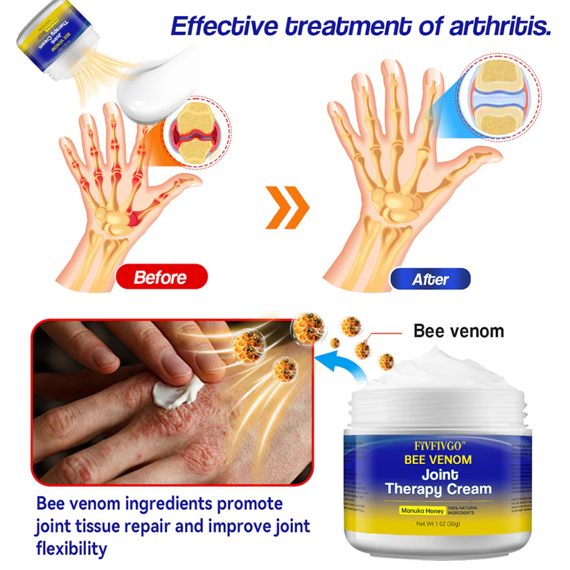 Fivfivgo™ Bee Venom Joint Therapy Cream: Relieves stiffness and swelling