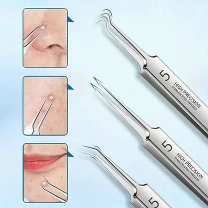 Professional Facial Blackhead Remover Tweezers