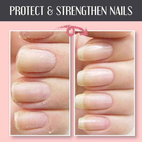 Nail Repair Protection Gel