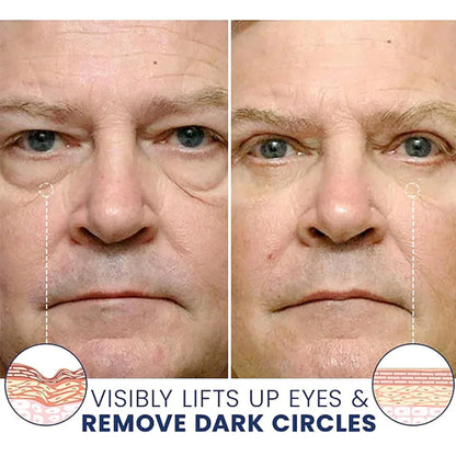 Uachtar níos doichte Eye Wrinkle Eye