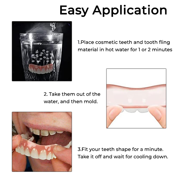 Seurico ™ Soft Denture Reline Kit