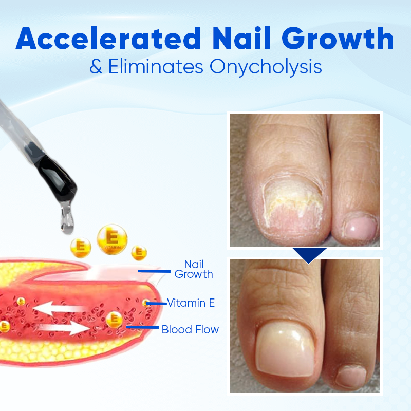 Sérum de croissance et de réparation des ongles OULISI ™