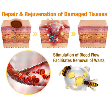 Flysmus ™ Tagrecede Bee Venom θεραπεία