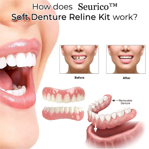 Kit de reline Soft Denture Soft Soft Soft