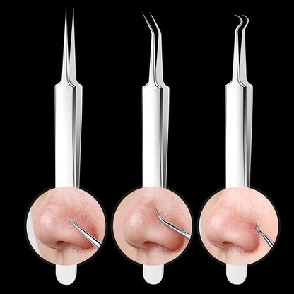 Professional Facial Blackhead Remover Tweezers